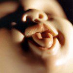 Diana Thorneycroft, Doll Mouth (laughing), 2005