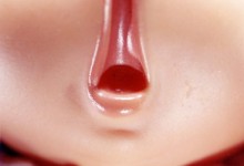 Diana Thorneycroft, Doll Mouth (yawn), 2005