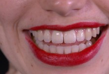 Ingrid Bachmann, Smile, 2017
